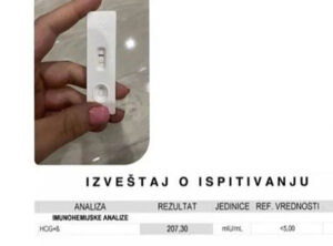 trudnoca iskustva9